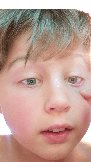 Nathan VS Burger